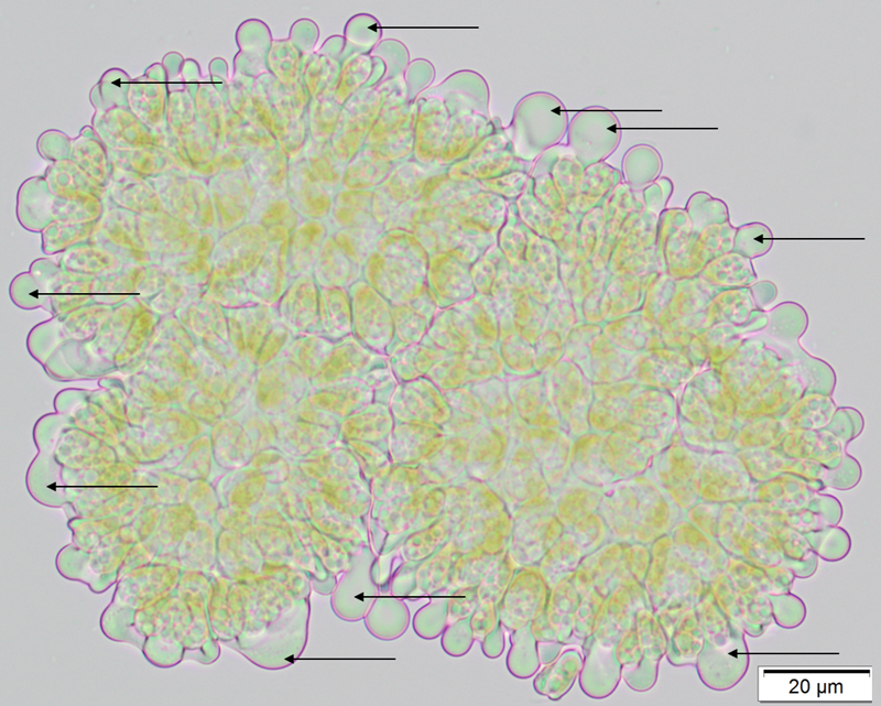 Labvolution19_LipideBotryo